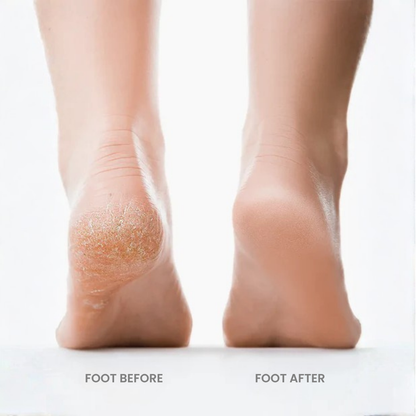Urbanzaa™ Smooth Heel Pro